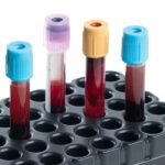 ANTICUERPOS ANTI FACTOR INTRINSECO