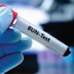NITROGENO UREICO (BUN)