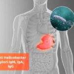 HELICOBACTER PYRLORI IGG