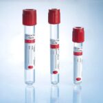 ANTICUERPOS ANTI TIROGLOBULINA