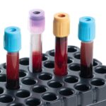 PERFIL PRUEBAS DE FUNCIÓN HEPÁTICA