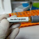 GLUCOSA TOMA 1HR.