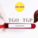 TGO